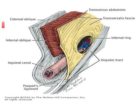 iliopubic tract - Αναζήτηση Google