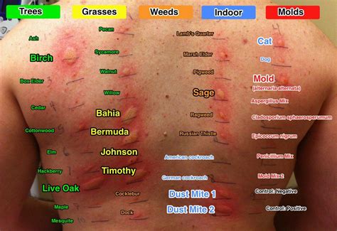 Identifying Skin Rashes In Adults