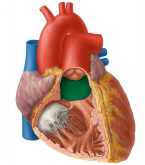 Conus Arteriosus