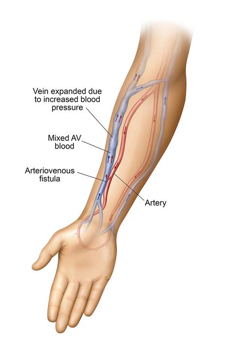 Diagram Of Veins And Arteries In Arm