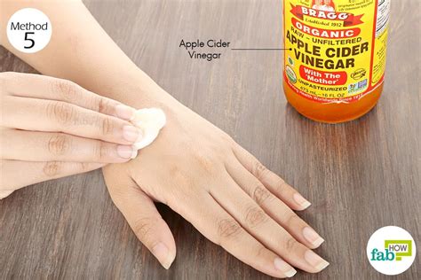 Itchy Skin Causes Treatment And Itchy Skin Home Remedies