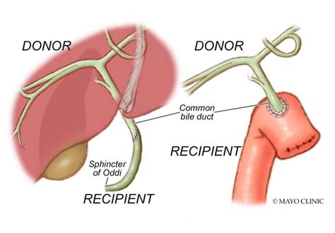 Endoscopic retrograde cholangiography versus percutaneous transhepatic ...