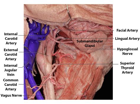 Carotid Endarterectomy | The Neurosurgical Atlas