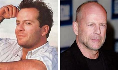 BRUCE WILLIS | Bruce willis, Bald actors, Balding