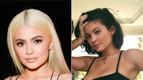 Kylie Jenner Removed Her Lip Filler | Teen Vogue