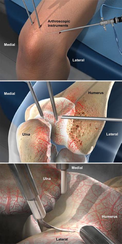 Knee FAQ’s – Page 2 – Brandon Orthopedics