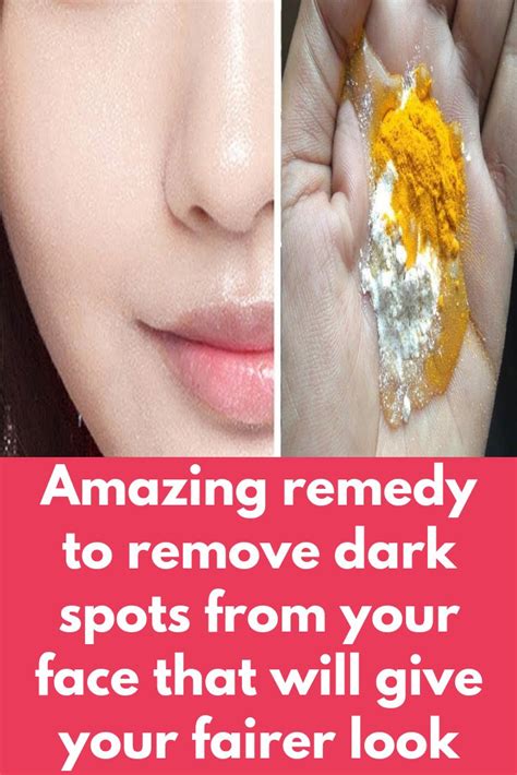 Amazing remedy to remove dark spots from your face that will give your ...