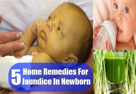 5 Home Remedies For Jaundice In Newborn | Home remedies, Remedies