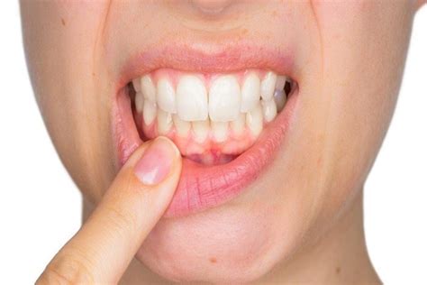 Try out these easy home remedies for gum problems - The Statesman