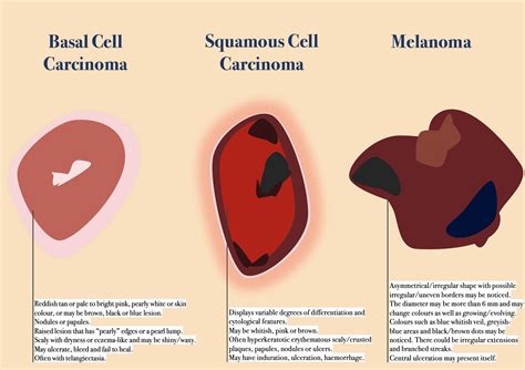 Skin Cancer Cells Vs Normal Cells