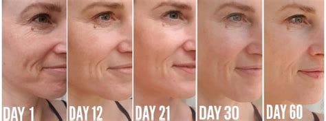 Collagen Before and After Pictures - Do you see the Difference?