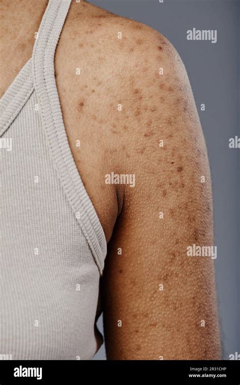 Closeup detail image of black young woman with real skin texture and ...