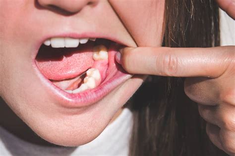 From Start To Finish: How Long Does A Tooth Extraction Take?