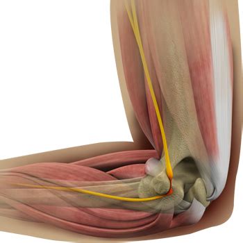 Cubital Tunnel Release | Seacoast Orthopedics & Sports Medicine ...