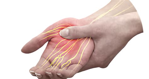 Peripheral Nerve Regeneration - Buckley Lab