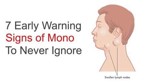 7 Early Warning Signs of Mono to Never Ignore | Power of Positivity