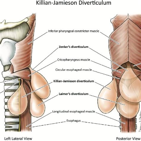 Anatomy of the hypopharynx. Killian-Jamieson space and its relation to ...