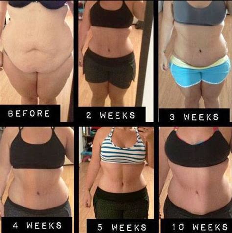 Lipo and tummy tuck recovery before and after photos » Tummy Tuck ...