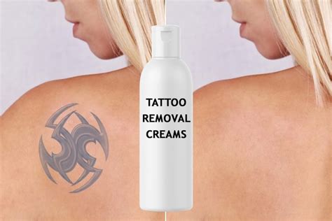 7 Tattoo Removal Creams Worth Investing On!