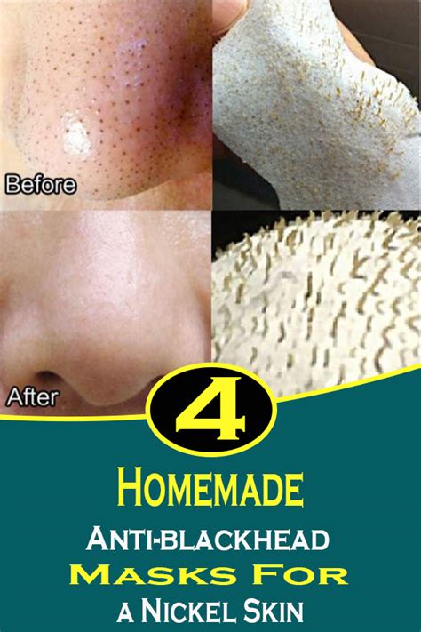 4 homemade anti-blackhead masks for a nickel skin - exstremboard