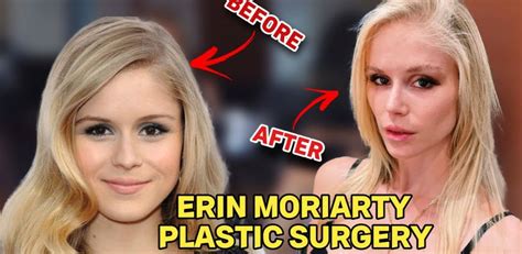 Erin Moriarty Nose Job, Plastic Surgery Before And After