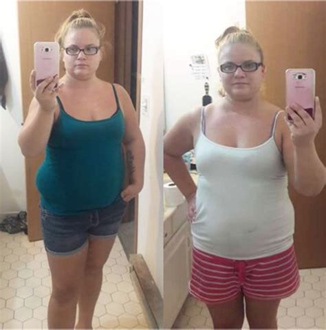 Top 92+ Background Images Before And After Phentermine Side Effects Latest