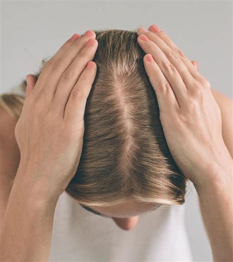 PCOS Hair Loss: Causes, Signs, Treatment, Remedies, And More