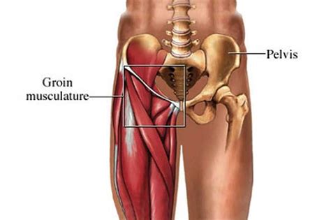 Groin Strain | Keystone Physiotherapy