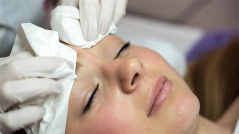 Woman Gets "Leech Facial" to Treat Her Acne — But Does It Work? | Allure