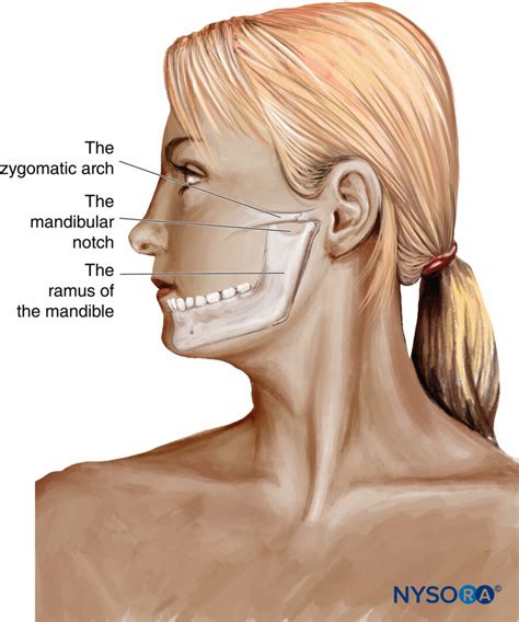 Mandibular Nerve Block