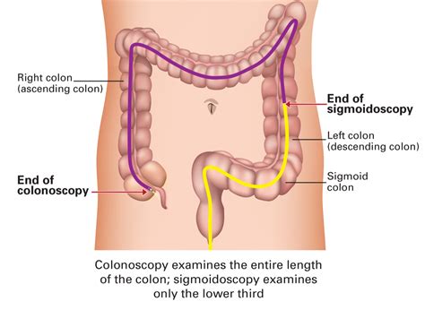 Colorectal cancer screening