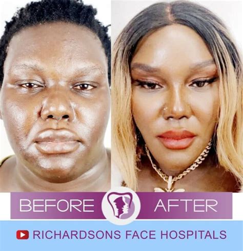 Four Things No One Told You About Complete Face Change Plastic Surgery ...