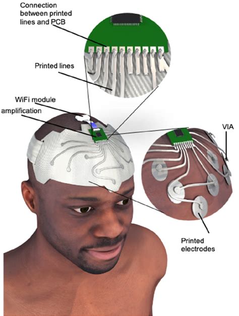 Wearable and comfortable e-textile headband for long-term acquisition ...