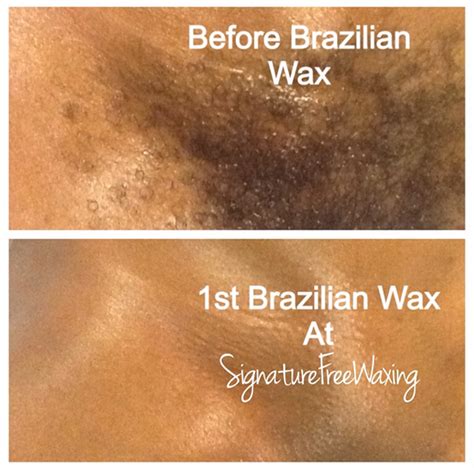 best brazilian wax chicago - Skye Handy