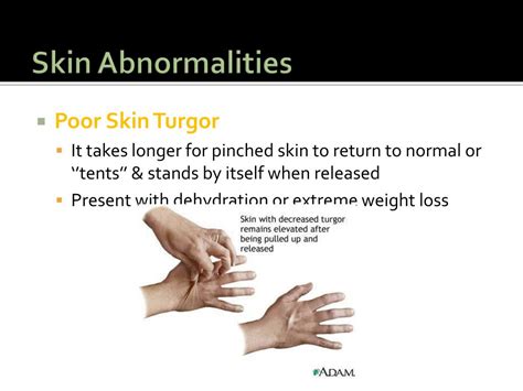 PPT - Physical Assessment Head, Neck, and Skin PowerPoint Presentation ...