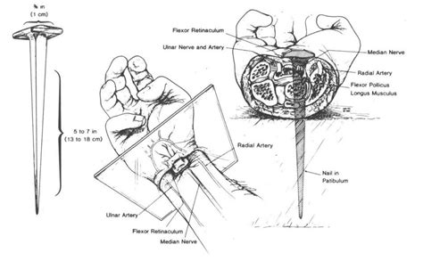 Jesus of Nazareth Crucifixion Photo Gallery 17 - Medical drawings of ...