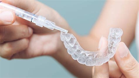 6 Facts About Teeth Whitening You Should Know - Hinsdale Dental