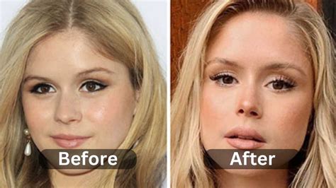 Erin Moriarty Plastic Surgery, Before & After | Myth or Reality ...