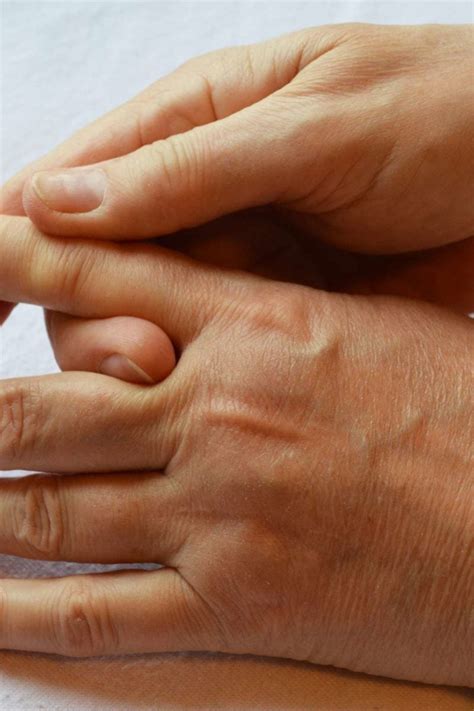 Stiff fingers: Causes, treatment, and stretches