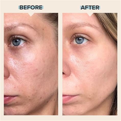 Paula's Choice Daily Pore-Refining Treatment Made Me Glow, 43% OFF