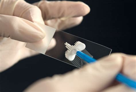 What is Pap Smear Test?Know the Procedure & Prices in India