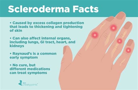 What is Scleroderma? Understanding Symptoms, Causes, and Treatments