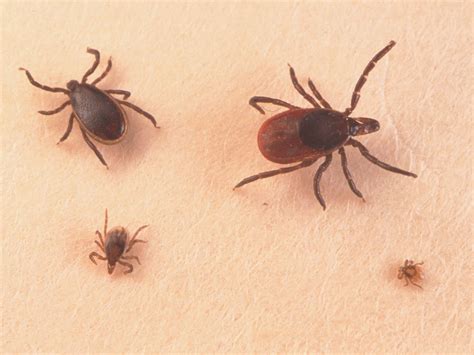 How To Remove A Tick Correctly Tick Removal Tips Prevention | lupon.gov.ph