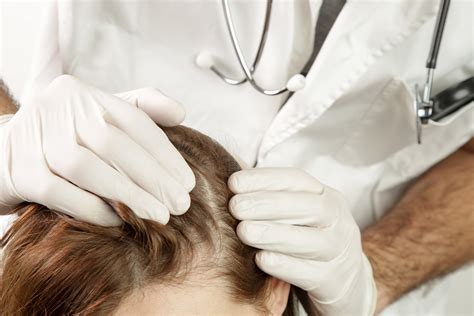 Scalp Psoriasis: Symptoms and Treatment | Mereltä – Merelta