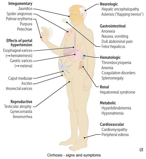 Liver Disease & Diet for Health