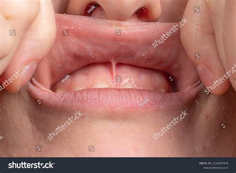 700 Labial 이미지, 스톡 사진 및 벡터 | Shutterstock