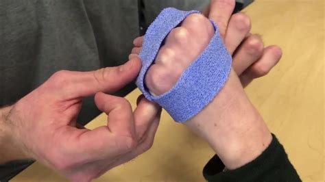 Anti Claw Orthosis - YouTube