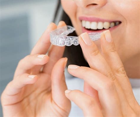 Things to Know Before Getting Your Set of Invisalign Aligners - CPO