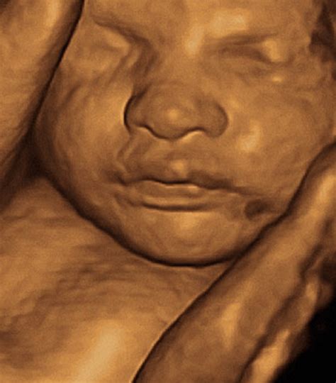 3d 30 Week Ultrasound: What To Expect? - Crying Toddlers