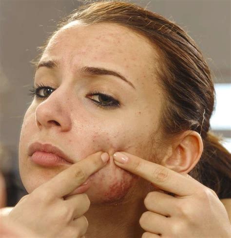 Infected pimple: Symptoms, diagnosis, and treatment